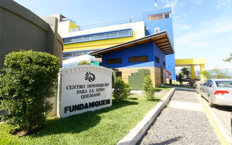 Menor ingresa con quemaduras en su mano por manipulación de pólvora a Fundaniquem