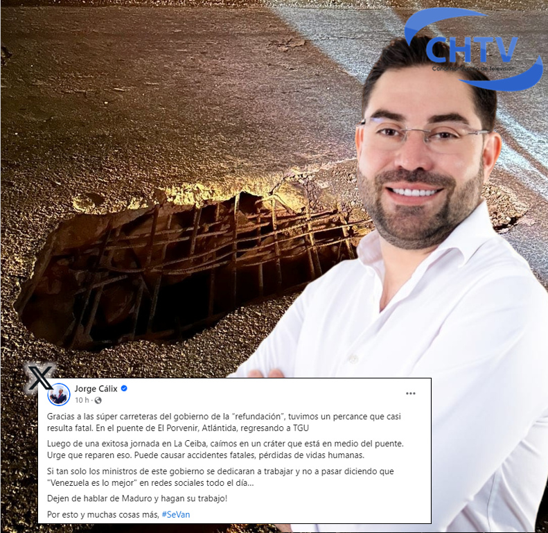 Jorge Cálix sufre accidente vial a causa de cráter en Atlántida