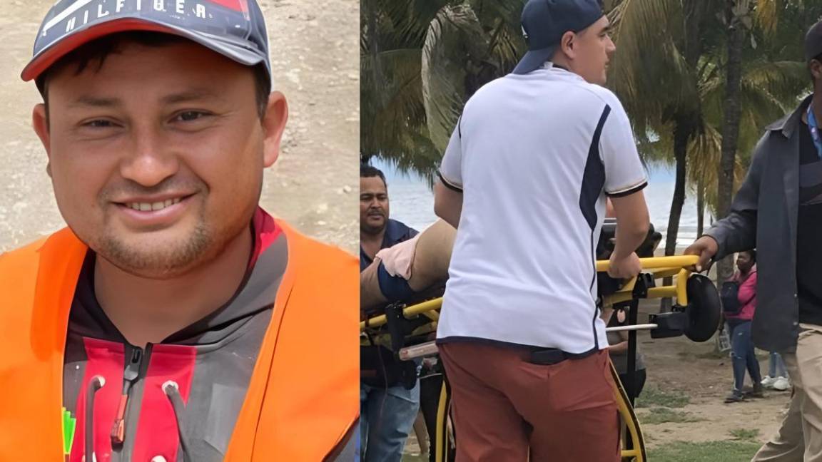 ¡Increíble! Hondureño mordido por tiburón en Tela aún no es operado por falta de insumos