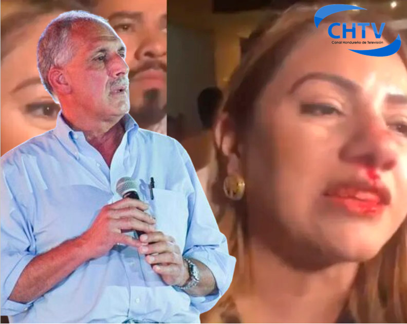 Nasry Asfura tras agresión a Sara Zavala: “Condeno la agresión física a Sara esto atenta contra los principios democráticos y la paz”