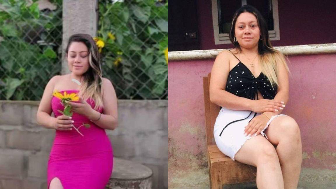 Fallece mujer que fue atacada a balazos por celos por su expareja en Danlí