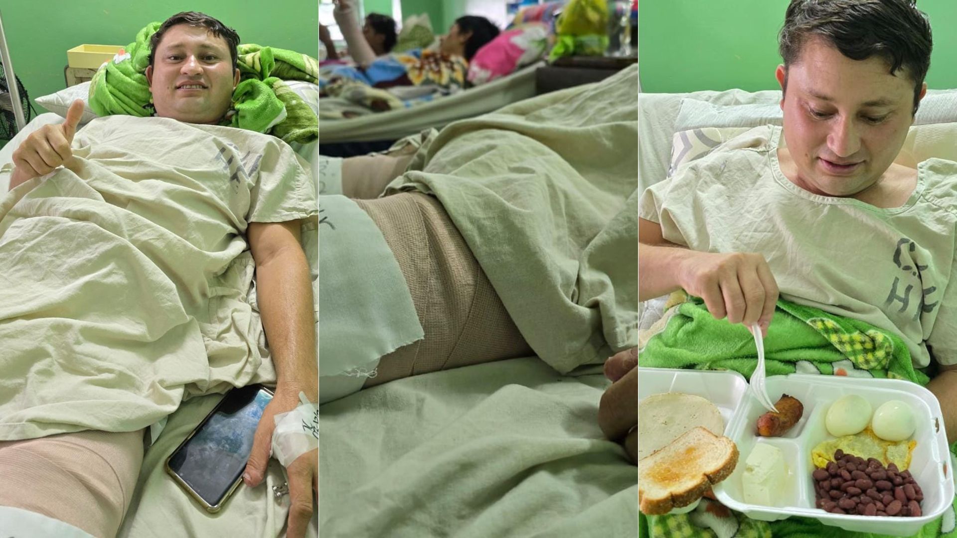 Hombre atacado por tiburón podría recibir el alta médica este fin de semana