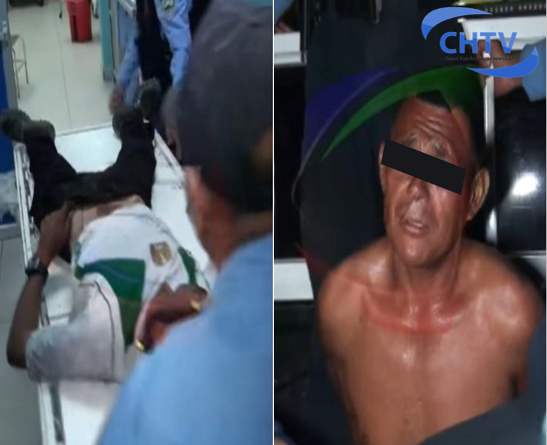¡Por el amor de una mujer! Hombre machetea al amante de su esposa en Choluteca