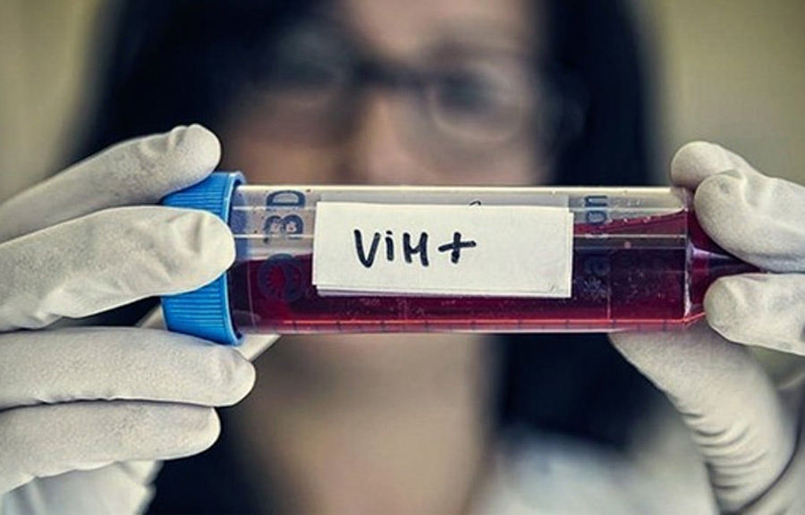 Honduras conmemora el día nacional de respuesta a la epidemia del VIH registrando una nueva infección cada ocho horas