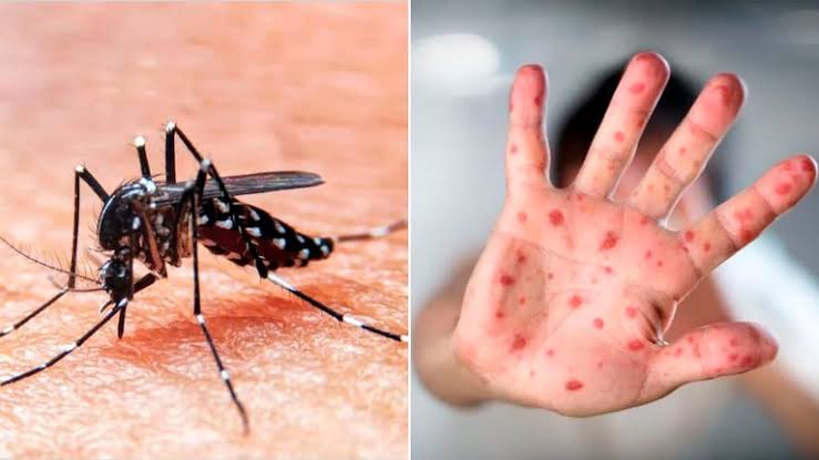 Salud confirma más de 8 mil casos de dengue y mantiene alerta por sarampión